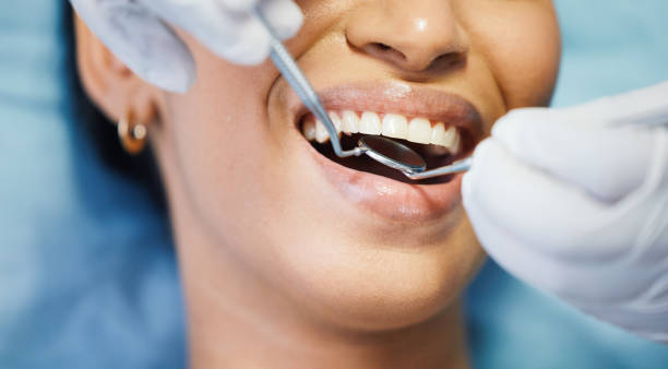 Best Broken or Cracked Tooth Emergency Dentist in Prospect Heights, IL