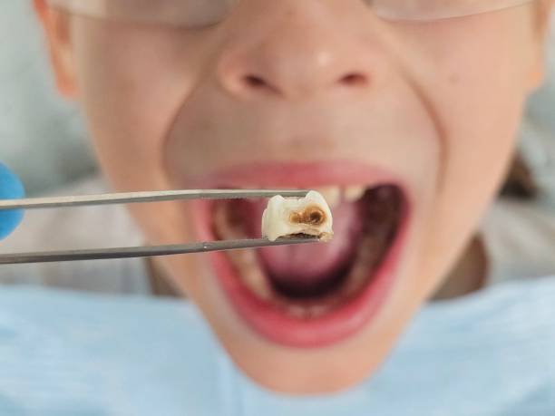 Best Emergency Dentist for Knocked-Out Tooth in Prospect Heights, IL